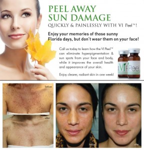 VI Peel Before and After
