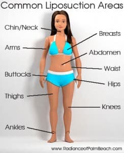 Common Liposuction Areas